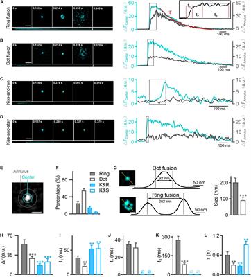 Hyperglycemia-Induced Dysregulated Fusion Intermediates in Insulin-Secreting Cells Visualized by Super-Resolution Microscopy